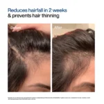 WishCare Hair Growth Serum Concentrate, 30 ml - Image 6