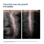 WishCare Hair Growth Serum Concentrate, 30 ml - Image 4