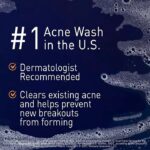 PanOxyl Acne Foaming Face And Body Wash With 10% Benzoyl Peroxide, 156 g - Image 4