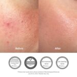 Dr Althea 345 Relief Face Cream, 50 ml - Image 2